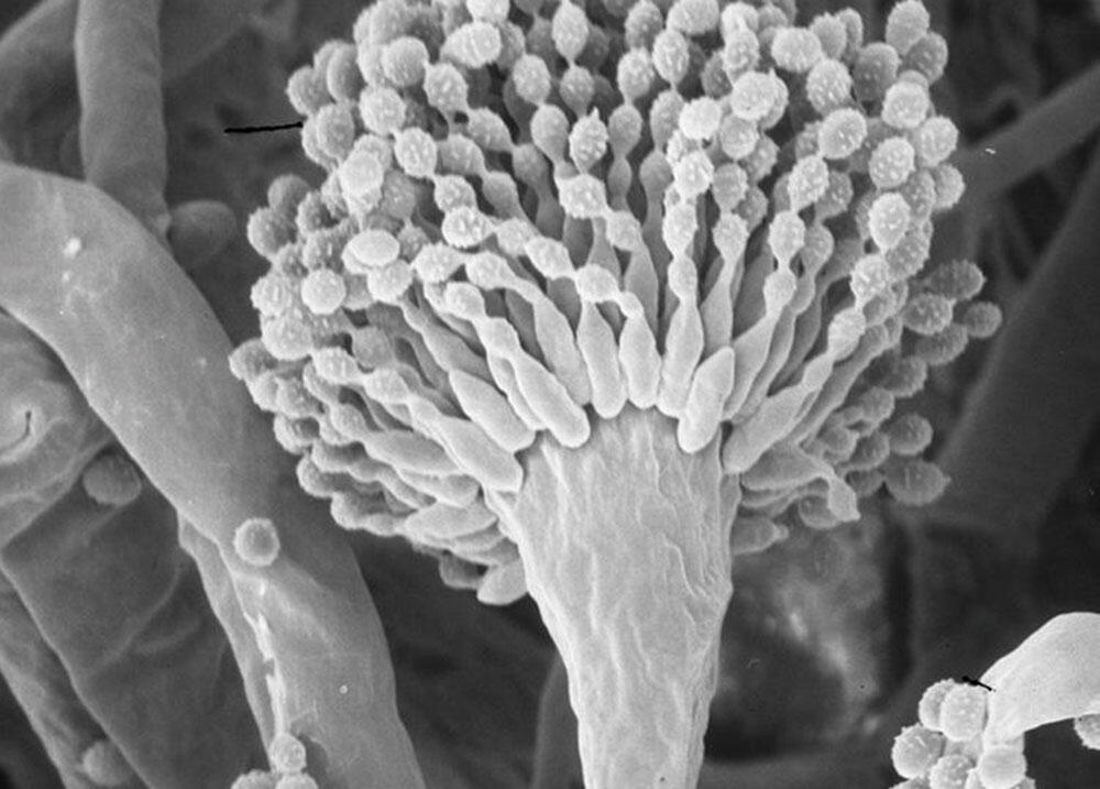 Medical Mycology Research Center (MMRC)